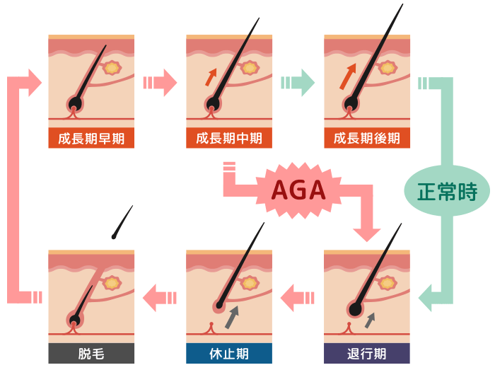 ヘアサイクルの図